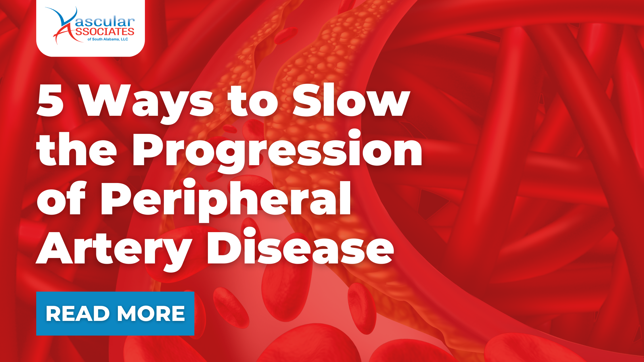 5 Ways to Slow  the Progression  of Peripheral  Artery Disease.png